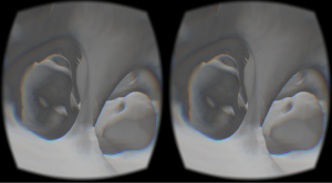 Oculus-Sinus-Demo-2